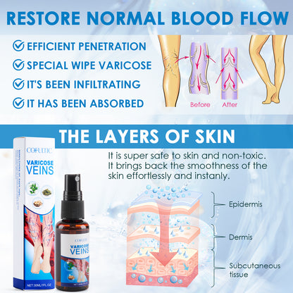 30ml Varicose Vein Spray Multi-Purpose Knee And Leg Care Spray